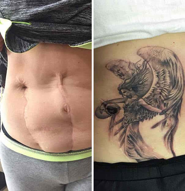30 Awesome Tattoos That Cover Up Scars