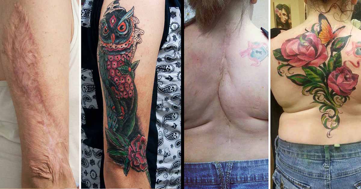 30 Awesome Tattoos That Cover Up Scars
