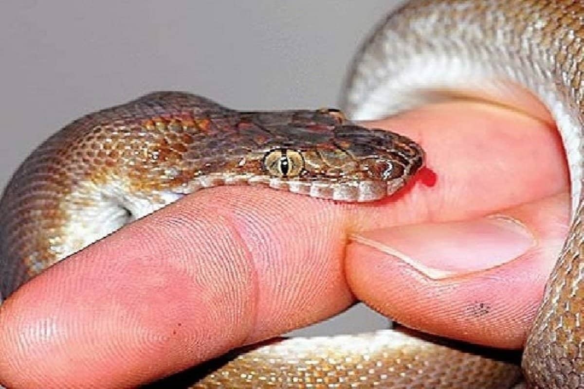 snake bite