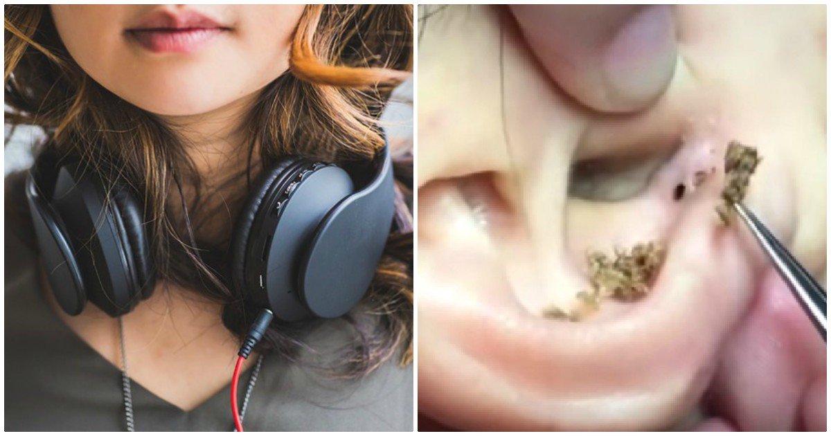 Prolonged Use Of Headphones Can Cause Blackheads In The Ear, Doctor Warns Elite Readers