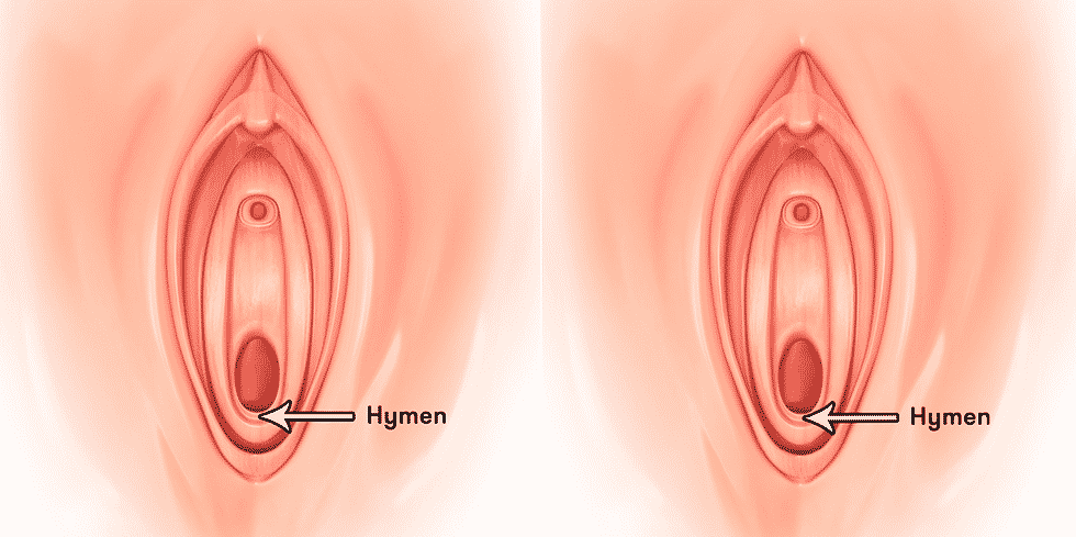 The hymen is a membrane that covers the vaginal opening. 