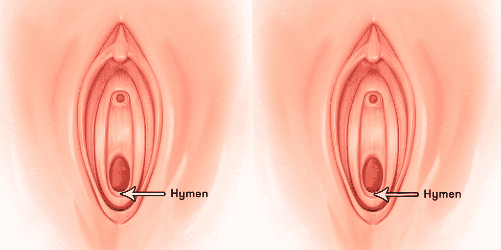 Busting The Myth About Female Virginity - Can You Tell A Vir